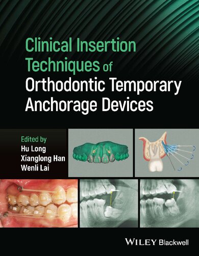 Clinical Insertion Techniques of Orthodontic Temporary Anchorage Devices